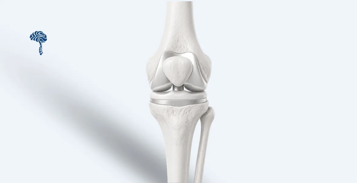 Joint Replacement (Knee, Shoulder & Elbow)