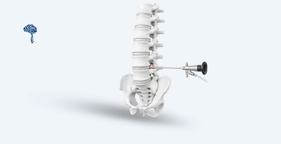 Spine Surgery
